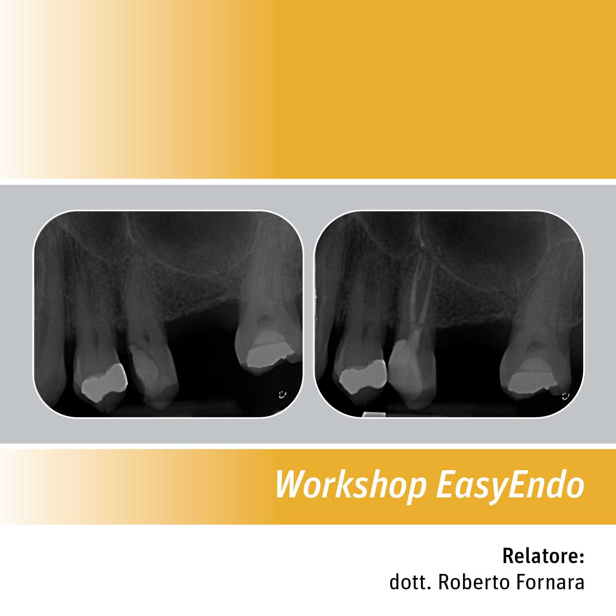 Workshop EasyEndo 2024